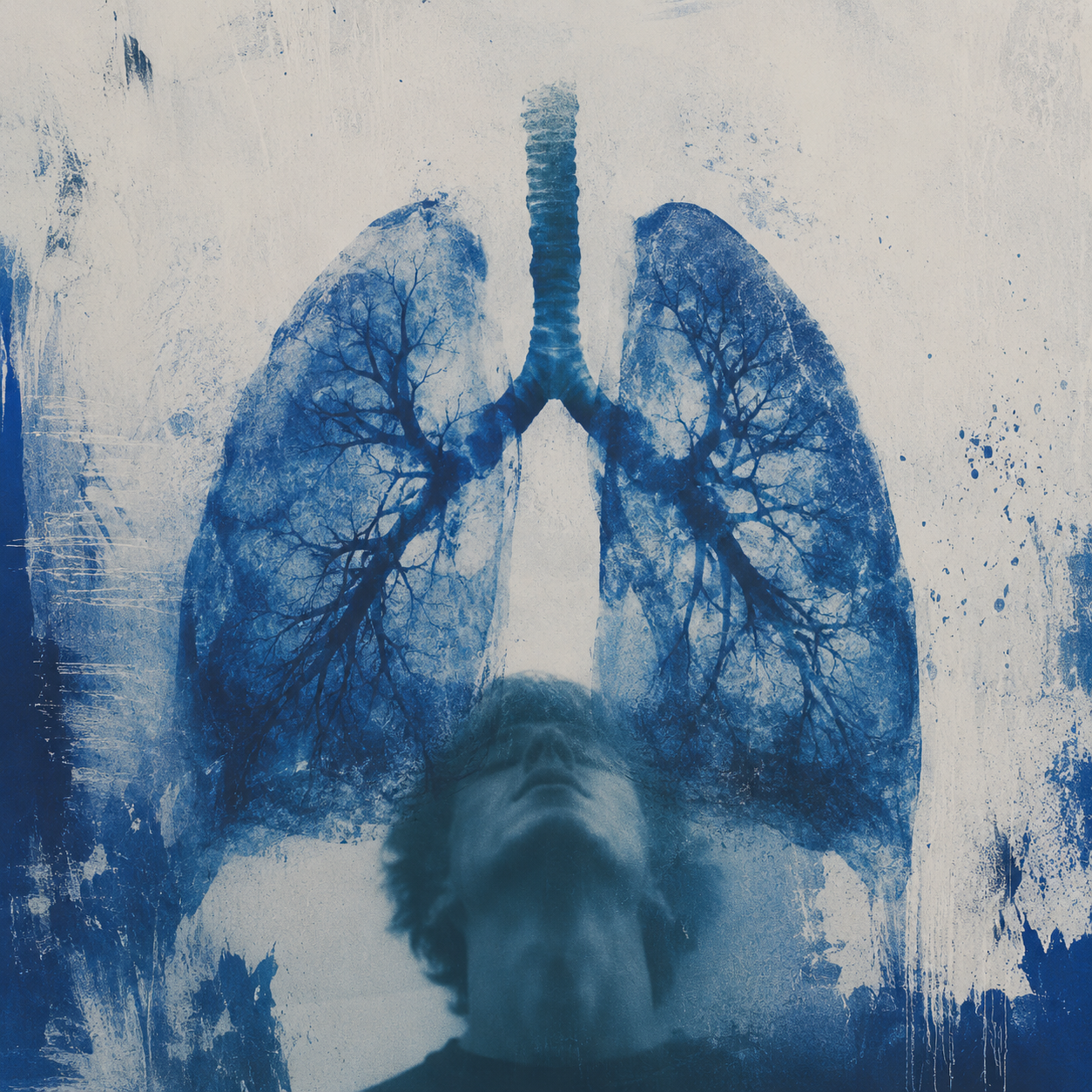 Blue Lungs